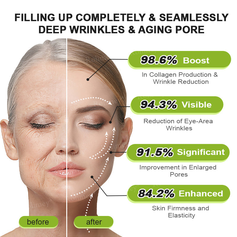 🔥 𝐅𝐥𝐚𝐬𝐡 𝐒𝐚𝐥𝐞: 𝟓𝟎% 𝐎𝐅𝐅 – 𝐑𝐨𝐥𝐢𝐦𝐞𝐲® 🧑‍⚕️ 𝐁𝐨𝐭𝐨𝐱-𝐋𝐢𝐤𝐞 𝐏𝐞𝐩𝐭𝐢𝐝𝐞𝐬 + 𝐕𝐢𝐭𝐚-𝐀 𝐑𝐞𝐭𝐢𝐧𝐨𝐥 𝐒𝐡𝐨𝐭 – 𝐖𝐫𝐢𝐧𝐤𝐥𝐞-𝐋𝐢𝐟𝐭 𝐓𝐢𝐠𝐡𝐭𝐞𝐧𝐢𝐧𝐠 𝐂𝐫𝐞𝐚𝐦