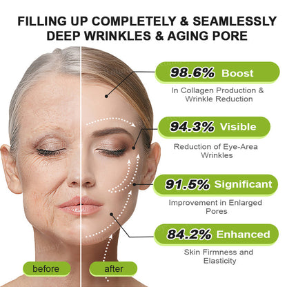 🔥 𝐅𝐥𝐚𝐬𝐡 𝐒𝐚𝐥𝐞: 𝟓𝟎% 𝐎𝐅𝐅 – 𝐑𝐨𝐥𝐢𝐦𝐞𝐲® 🧑‍⚕️ 𝐁𝐨𝐭𝐨𝐱-𝐋𝐢𝐤𝐞 𝐏𝐞𝐩𝐭𝐢𝐝𝐞𝐬 + 𝐕𝐢𝐭𝐚-𝐀 𝐑𝐞𝐭𝐢𝐧𝐨𝐥 𝐒𝐡𝐨𝐭 – 𝐖𝐫𝐢𝐧𝐤𝐥𝐞-𝐋𝐢𝐟𝐭 𝐓𝐢𝐠𝐡𝐭𝐞𝐧𝐢𝐧𝐠 𝐂𝐫𝐞𝐚𝐦