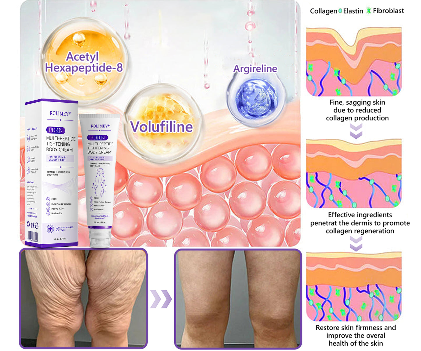 💜ROLIMEY® 𝐏𝐃𝐑𝐍 𝐌𝐮𝐥𝐭𝐢-𝐏𝐞𝐩𝐭𝐢𝐝𝐞 𝐌𝐚𝐬𝐬𝐚𝐠𝐢𝐧𝐠 𝐁𝐨𝐝𝐲 𝐑𝐨𝐥𝐥𝐞𝐫 𝐂𝐫𝐞𝐚𝐦- 𝐀𝐧𝐭𝐢-𝐚𝐠𝐢𝐧𝐠, 𝐇𝐲𝐝𝐫𝐚𝐭𝐢𝐧𝐠, 𝐒𝐤𝐢𝐧 𝐅𝐢𝐫𝐦𝐢𝐧𝐠 & 𝐋𝐢𝐟𝐭𝐢𝐧𝐠, 𝐒𝐤𝐢𝐧 𝐑𝐞𝐩𝐚𝐢𝐫, 𝐄𝐯𝐞𝐧 𝐓𝐨𝐧𝐞, 𝐀𝐜𝐧𝐞 𝐚𝐧𝐝 𝐃𝐚𝐫𝐤 𝐒𝐩𝐨𝐭 𝐓𝐫𝐞𝐚𝐭𝐦𝐞𝐧𝐭, 𝐖𝐚𝐫𝐭 𝐚𝐧𝐝 𝐌𝐨𝐥𝐞 𝐑𝐞𝐦𝐨𝐯𝐚𝐥, 𝐚𝐧𝐝 𝐏𝐬𝐨𝐫𝐢𝐚𝐬𝐢𝐬 𝐑𝐞𝐥𝐢𝐞𝐟.