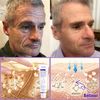 💜ROLIMEY® 𝐏𝐃𝐑𝐍 𝐌𝐮𝐥𝐭𝐢-𝐏𝐞𝐩𝐭𝐢𝐝𝐞 𝐌𝐚𝐬𝐬𝐚𝐠𝐢𝐧𝐠 𝐁𝐨𝐝𝐲 𝐑𝐨𝐥𝐥𝐞𝐫 𝐂𝐫𝐞𝐚𝐦- 𝐀𝐧𝐭𝐢-𝐚𝐠𝐢𝐧𝐠, 𝐇𝐲𝐝𝐫𝐚𝐭𝐢𝐧𝐠, 𝐒𝐤𝐢𝐧 𝐅𝐢𝐫𝐦𝐢𝐧𝐠 & 𝐋𝐢𝐟𝐭𝐢𝐧𝐠, 𝐒𝐤𝐢𝐧 𝐑𝐞𝐩𝐚𝐢𝐫, 𝐄𝐯𝐞𝐧 𝐓𝐨𝐧𝐞, 𝐀𝐜𝐧𝐞 𝐚𝐧𝐝 𝐃𝐚𝐫𝐤 𝐒𝐩𝐨𝐭 𝐓𝐫𝐞𝐚𝐭𝐦𝐞𝐧𝐭, 𝐖𝐚𝐫𝐭 𝐚𝐧𝐝 𝐌𝐨𝐥𝐞 𝐑𝐞𝐦𝐨𝐯𝐚𝐥, 𝐚𝐧𝐝 𝐏𝐬𝐨𝐫𝐢𝐚𝐬𝐢𝐬 𝐑𝐞𝐥𝐢𝐞𝐟.