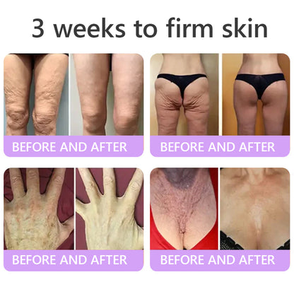 💜ROLIMEY® 𝐏𝐃𝐑𝐍 𝐌𝐮𝐥𝐭𝐢-𝐏𝐞𝐩𝐭𝐢𝐝𝐞 𝐌𝐚𝐬𝐬𝐚𝐠𝐢𝐧𝐠 𝐁𝐨𝐝𝐲 𝐑𝐨𝐥𝐥𝐞𝐫 𝐂𝐫𝐞𝐚𝐦- 𝐀𝐧𝐭𝐢-𝐚𝐠𝐢𝐧𝐠, 𝐇𝐲𝐝𝐫𝐚𝐭𝐢𝐧𝐠, 𝐒𝐤𝐢𝐧 𝐅𝐢𝐫𝐦𝐢𝐧𝐠 & 𝐋𝐢𝐟𝐭𝐢𝐧𝐠, 𝐒𝐤𝐢𝐧 𝐑𝐞𝐩𝐚𝐢𝐫, 𝐄𝐯𝐞𝐧 𝐓𝐨𝐧𝐞, 𝐀𝐜𝐧𝐞 𝐚𝐧𝐝 𝐃𝐚𝐫𝐤 𝐒𝐩𝐨𝐭 𝐓𝐫𝐞𝐚𝐭𝐦𝐞𝐧𝐭, 𝐖𝐚𝐫𝐭 𝐚𝐧𝐝 𝐌𝐨𝐥𝐞 𝐑𝐞𝐦𝐨𝐯𝐚𝐥, 𝐚𝐧𝐝 𝐏𝐬𝐨𝐫𝐢𝐚𝐬𝐢𝐬 𝐑𝐞𝐥𝐢𝐞𝐟.