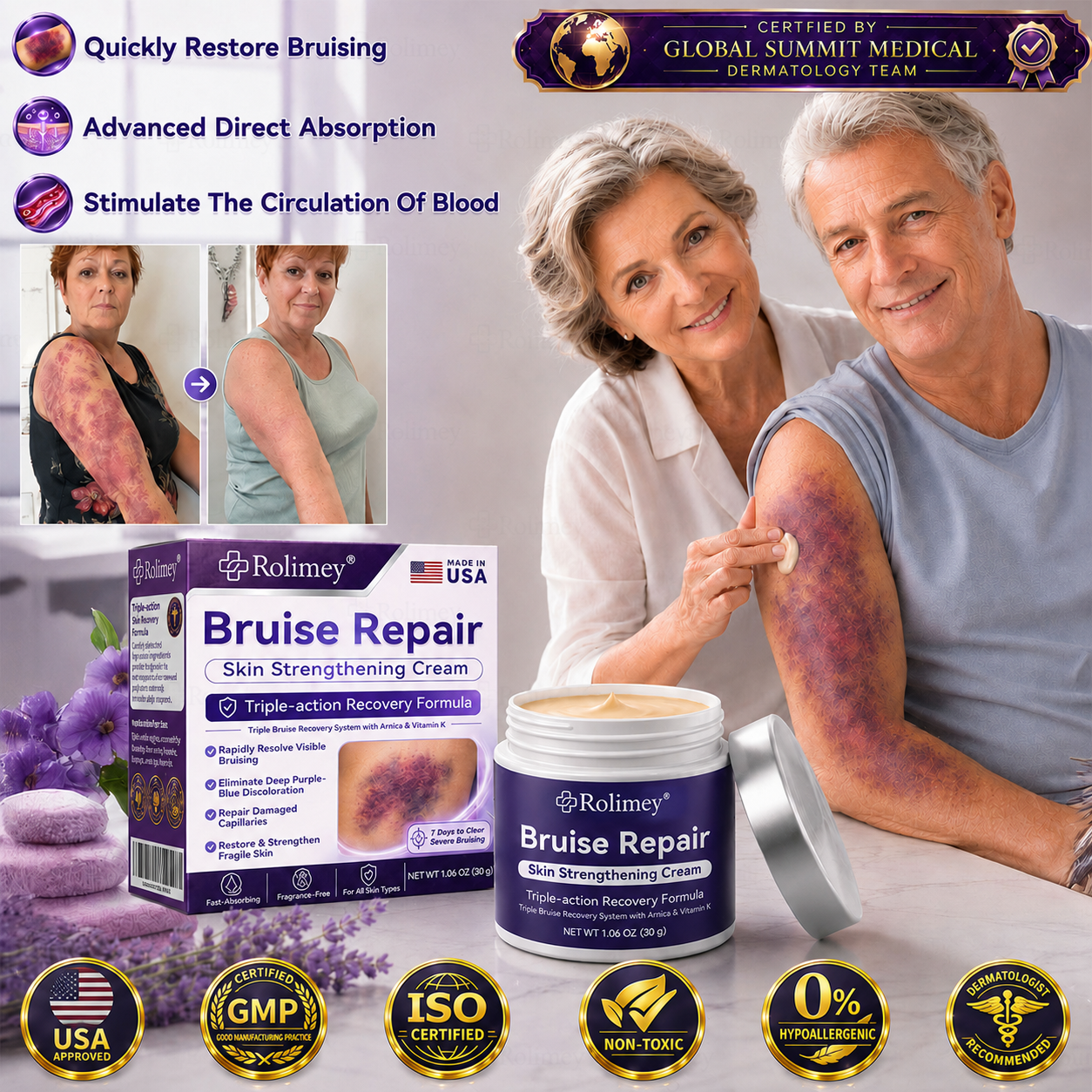 👨‍⚕️Over 100,000 units sold💕 - Rolimey® cream to repair bruises and strengthen the skin.