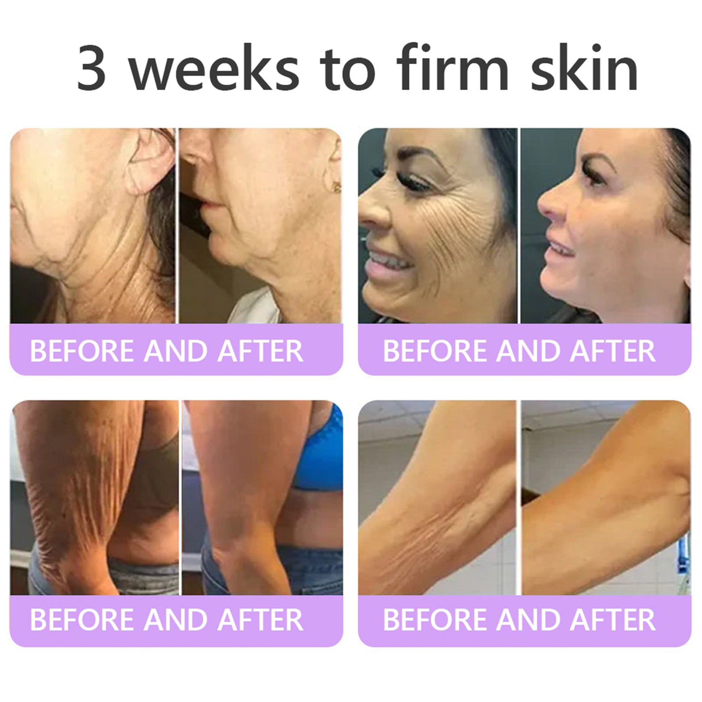 💜ROLIMEY® 𝐏𝐃𝐑𝐍 𝐌𝐮𝐥𝐭𝐢-𝐏𝐞𝐩𝐭𝐢𝐝𝐞 𝐌𝐚𝐬𝐬𝐚𝐠𝐢𝐧𝐠 𝐁𝐨𝐝𝐲 𝐑𝐨𝐥𝐥𝐞𝐫 𝐂𝐫𝐞𝐚𝐦- 𝐀𝐧𝐭𝐢-𝐚𝐠𝐢𝐧𝐠, 𝐇𝐲𝐝𝐫𝐚𝐭𝐢𝐧𝐠, 𝐒𝐤𝐢𝐧 𝐅𝐢𝐫𝐦𝐢𝐧𝐠 & 𝐋𝐢𝐟𝐭𝐢𝐧𝐠, 𝐒𝐤𝐢𝐧 𝐑𝐞𝐩𝐚𝐢𝐫, 𝐄𝐯𝐞𝐧 𝐓𝐨𝐧𝐞, 𝐀𝐜𝐧𝐞 𝐚𝐧𝐝 𝐃𝐚𝐫𝐤 𝐒𝐩𝐨𝐭 𝐓𝐫𝐞𝐚𝐭𝐦𝐞𝐧𝐭, 𝐖𝐚𝐫𝐭 𝐚𝐧𝐝 𝐌𝐨𝐥𝐞 𝐑𝐞𝐦𝐨𝐯𝐚𝐥, 𝐚𝐧𝐝 𝐏𝐬𝐨𝐫𝐢𝐚𝐬𝐢𝐬 𝐑𝐞𝐥𝐢𝐞𝐟.
