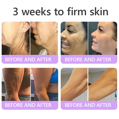 💜ROLIMEY® 𝐏𝐃𝐑𝐍 𝐌𝐮𝐥𝐭𝐢-𝐏𝐞𝐩𝐭𝐢𝐝𝐞 𝐌𝐚𝐬𝐬𝐚𝐠𝐢𝐧𝐠 𝐁𝐨𝐝𝐲 𝐑𝐨𝐥𝐥𝐞𝐫 𝐂𝐫𝐞𝐚𝐦- 𝐀𝐧𝐭𝐢-𝐚𝐠𝐢𝐧𝐠, 𝐇𝐲𝐝𝐫𝐚𝐭𝐢𝐧𝐠, 𝐒𝐤𝐢𝐧 𝐅𝐢𝐫𝐦𝐢𝐧𝐠 & 𝐋𝐢𝐟𝐭𝐢𝐧𝐠, 𝐒𝐤𝐢𝐧 𝐑𝐞𝐩𝐚𝐢𝐫, 𝐄𝐯𝐞𝐧 𝐓𝐨𝐧𝐞, 𝐀𝐜𝐧𝐞 𝐚𝐧𝐝 𝐃𝐚𝐫𝐤 𝐒𝐩𝐨𝐭 𝐓𝐫𝐞𝐚𝐭𝐦𝐞𝐧𝐭, 𝐖𝐚𝐫𝐭 𝐚𝐧𝐝 𝐌𝐨𝐥𝐞 𝐑𝐞𝐦𝐨𝐯𝐚𝐥, 𝐚𝐧𝐝 𝐏𝐬𝐨𝐫𝐢𝐚𝐬𝐢𝐬 𝐑𝐞𝐥𝐢𝐞𝐟.