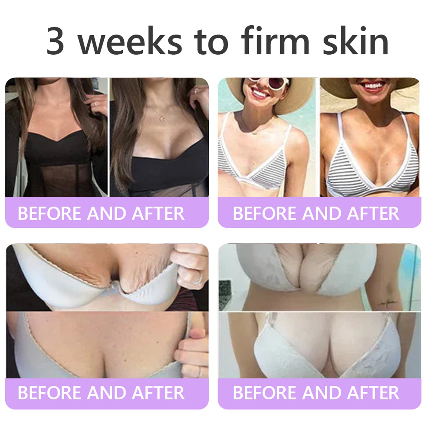 💜ROLIMEY® 𝐏𝐃𝐑𝐍 𝐌𝐮𝐥𝐭𝐢-𝐏𝐞𝐩𝐭𝐢𝐝𝐞 𝐌𝐚𝐬𝐬𝐚𝐠𝐢𝐧𝐠 𝐁𝐨𝐝𝐲 𝐑𝐨𝐥𝐥𝐞𝐫 𝐂𝐫𝐞𝐚𝐦- 𝐀𝐧𝐭𝐢-𝐚𝐠𝐢𝐧𝐠, 𝐇𝐲𝐝𝐫𝐚𝐭𝐢𝐧𝐠, 𝐒𝐤𝐢𝐧 𝐅𝐢𝐫𝐦𝐢𝐧𝐠 & 𝐋𝐢𝐟𝐭𝐢𝐧𝐠, 𝐒𝐤𝐢𝐧 𝐑𝐞𝐩𝐚𝐢𝐫, 𝐄𝐯𝐞𝐧 𝐓𝐨𝐧𝐞, 𝐀𝐜𝐧𝐞 𝐚𝐧𝐝 𝐃𝐚𝐫𝐤 𝐒𝐩𝐨𝐭 𝐓𝐫𝐞𝐚𝐭𝐦𝐞𝐧𝐭, 𝐖𝐚𝐫𝐭 𝐚𝐧𝐝 𝐌𝐨𝐥𝐞 𝐑𝐞𝐦𝐨𝐯𝐚𝐥, 𝐚𝐧𝐝 𝐏𝐬𝐨𝐫𝐢𝐚𝐬𝐢𝐬 𝐑𝐞𝐥𝐢𝐞𝐟.