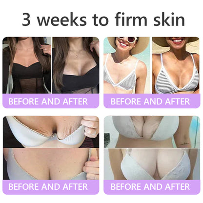 💜ROLIMEY® 𝐏𝐃𝐑𝐍 𝐌𝐮𝐥𝐭𝐢-𝐏𝐞𝐩𝐭𝐢𝐝𝐞 𝐌𝐚𝐬𝐬𝐚𝐠𝐢𝐧𝐠 𝐁𝐨𝐝𝐲 𝐑𝐨𝐥𝐥𝐞𝐫 𝐂𝐫𝐞𝐚𝐦- 𝐀𝐧𝐭𝐢-𝐚𝐠𝐢𝐧𝐠, 𝐇𝐲𝐝𝐫𝐚𝐭𝐢𝐧𝐠, 𝐒𝐤𝐢𝐧 𝐅𝐢𝐫𝐦𝐢𝐧𝐠 & 𝐋𝐢𝐟𝐭𝐢𝐧𝐠, 𝐒𝐤𝐢𝐧 𝐑𝐞𝐩𝐚𝐢𝐫, 𝐄𝐯𝐞𝐧 𝐓𝐨𝐧𝐞, 𝐀𝐜𝐧𝐞 𝐚𝐧𝐝 𝐃𝐚𝐫𝐤 𝐒𝐩𝐨𝐭 𝐓𝐫𝐞𝐚𝐭𝐦𝐞𝐧𝐭, 𝐖𝐚𝐫𝐭 𝐚𝐧𝐝 𝐌𝐨𝐥𝐞 𝐑𝐞𝐦𝐨𝐯𝐚𝐥, 𝐚𝐧𝐝 𝐏𝐬𝐨𝐫𝐢𝐚𝐬𝐢𝐬 𝐑𝐞𝐥𝐢𝐞𝐟.