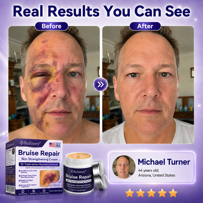 👨‍⚕️Over 100,000 units sold💕 - Rolimey® cream to repair bruises and strengthen the skin.