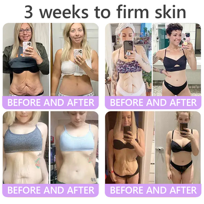 💜ROLIMEY® 𝐏𝐃𝐑𝐍 𝐌𝐮𝐥𝐭𝐢-𝐏𝐞𝐩𝐭𝐢𝐝𝐞 𝐌𝐚𝐬𝐬𝐚𝐠𝐢𝐧𝐠 𝐁𝐨𝐝𝐲 𝐑𝐨𝐥𝐥𝐞𝐫 𝐂𝐫𝐞𝐚𝐦- 𝐀𝐧𝐭𝐢-𝐚𝐠𝐢𝐧𝐠, 𝐇𝐲𝐝𝐫𝐚𝐭𝐢𝐧𝐠, 𝐒𝐤𝐢𝐧 𝐅𝐢𝐫𝐦𝐢𝐧𝐠 & 𝐋𝐢𝐟𝐭𝐢𝐧𝐠, 𝐒𝐤𝐢𝐧 𝐑𝐞𝐩𝐚𝐢𝐫, 𝐄𝐯𝐞𝐧 𝐓𝐨𝐧𝐞, 𝐀𝐜𝐧𝐞 𝐚𝐧𝐝 𝐃𝐚𝐫𝐤 𝐒𝐩𝐨𝐭 𝐓𝐫𝐞𝐚𝐭𝐦𝐞𝐧𝐭, 𝐖𝐚𝐫𝐭 𝐚𝐧𝐝 𝐌𝐨𝐥𝐞 𝐑𝐞𝐦𝐨𝐯𝐚𝐥, 𝐚𝐧𝐝 𝐏𝐬𝐨𝐫𝐢𝐚𝐬𝐢𝐬 𝐑𝐞𝐥𝐢𝐞𝐟.
