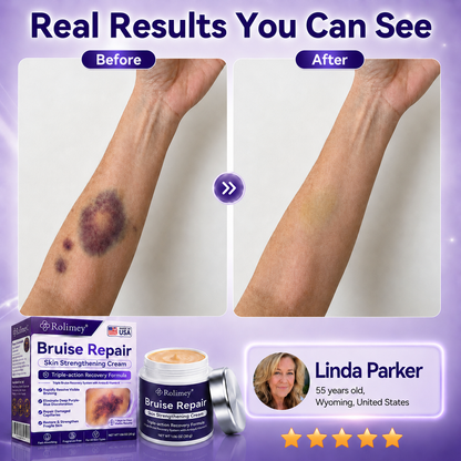 👨‍⚕️Over 100,000 units sold💕 - Rolimey® cream to repair bruises and strengthen the skin.