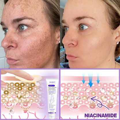 💜ROLIMEY® 𝐏𝐃𝐑𝐍 𝐌𝐮𝐥𝐭𝐢-𝐏𝐞𝐩𝐭𝐢𝐝𝐞 𝐌𝐚𝐬𝐬𝐚𝐠𝐢𝐧𝐠 𝐁𝐨𝐝𝐲 𝐑𝐨𝐥𝐥𝐞𝐫 𝐂𝐫𝐞𝐚𝐦- 𝐀𝐧𝐭𝐢-𝐚𝐠𝐢𝐧𝐠, 𝐇𝐲𝐝𝐫𝐚𝐭𝐢𝐧𝐠, 𝐒𝐤𝐢𝐧 𝐅𝐢𝐫𝐦𝐢𝐧𝐠 & 𝐋𝐢𝐟𝐭𝐢𝐧𝐠, 𝐒𝐤𝐢𝐧 𝐑𝐞𝐩𝐚𝐢𝐫, 𝐄𝐯𝐞𝐧 𝐓𝐨𝐧𝐞, 𝐀𝐜𝐧𝐞 𝐚𝐧𝐝 𝐃𝐚𝐫𝐤 𝐒𝐩𝐨𝐭 𝐓𝐫𝐞𝐚𝐭𝐦𝐞𝐧𝐭, 𝐖𝐚𝐫𝐭 𝐚𝐧𝐝 𝐌𝐨𝐥𝐞 𝐑𝐞𝐦𝐨𝐯𝐚𝐥, 𝐚𝐧𝐝 𝐏𝐬𝐨𝐫𝐢𝐚𝐬𝐢𝐬 𝐑𝐞𝐥𝐢𝐞𝐟.
