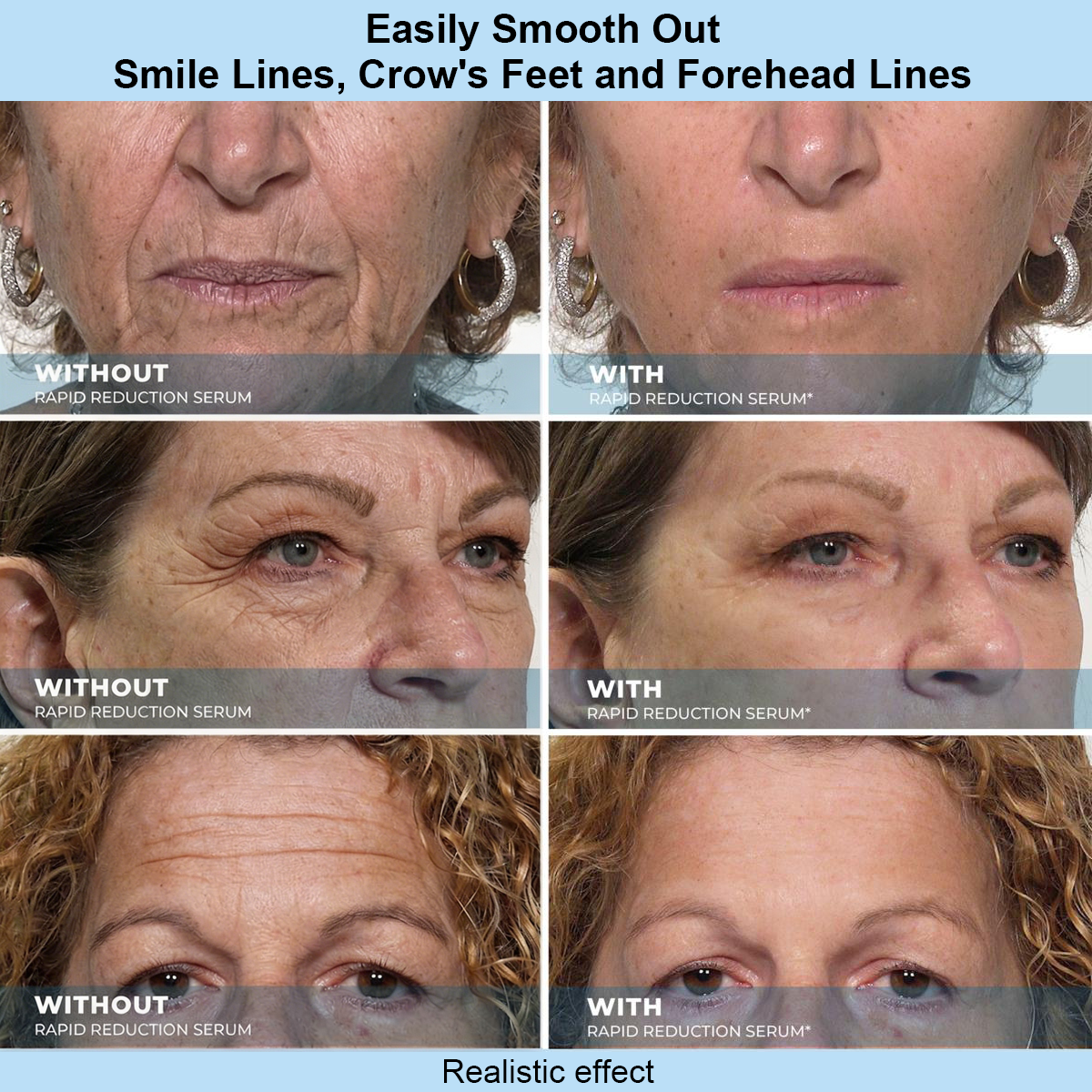 🔥 𝐅𝐥𝐚𝐬𝐡 𝐒𝐚𝐥𝐞: 𝟕𝟎% 𝐎𝐅𝐅 –𝐓𝐫𝐢𝐥𝐮𝐦𝐢𝐚® 𝐈𝐧𝐬𝐭𝐚𝐧𝐭 𝐅𝐚𝐜𝐞 𝐓𝐞𝐦𝐩𝐨𝐫𝐚𝐫𝐲 𝐓𝐢𝐠𝐡𝐭𝐞𝐧𝐞𝐫 – 𝐈𝐧𝐬𝐭𝐚𝐧𝐭 𝐯𝐢𝐬𝐢𝐛𝐥𝐞 𝐫𝐞𝐬𝐮𝐥𝐭𝐬 𝐢𝐧 𝟑𝟎 𝐬𝐞𝐜𝐨𝐧𝐝𝐬