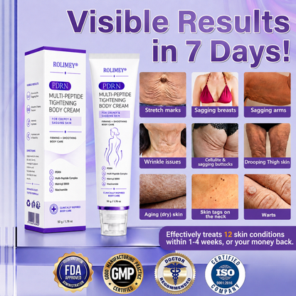 💜ROLIMEY® 𝐏𝐃𝐑𝐍 𝐌𝐮𝐥𝐭𝐢-𝐏𝐞𝐩𝐭𝐢𝐝𝐞 𝐌𝐚𝐬𝐬𝐚𝐠𝐢𝐧𝐠 𝐁𝐨𝐝𝐲 𝐑𝐨𝐥𝐥𝐞𝐫 𝐂𝐫𝐞𝐚𝐦- 𝐀𝐧𝐭𝐢-𝐚𝐠𝐢𝐧𝐠, 𝐇𝐲𝐝𝐫𝐚𝐭𝐢𝐧𝐠, 𝐒𝐤𝐢𝐧 𝐅𝐢𝐫𝐦𝐢𝐧𝐠 & 𝐋𝐢𝐟𝐭𝐢𝐧𝐠, 𝐒𝐤𝐢𝐧 𝐑𝐞𝐩𝐚𝐢𝐫, 𝐄𝐯𝐞𝐧 𝐓𝐨𝐧𝐞, 𝐀𝐜𝐧𝐞 𝐚𝐧𝐝 𝐃𝐚𝐫𝐤 𝐒𝐩𝐨𝐭 𝐓𝐫𝐞𝐚𝐭𝐦𝐞𝐧𝐭, 𝐖𝐚𝐫𝐭 𝐚𝐧𝐝 𝐌𝐨𝐥𝐞 𝐑𝐞𝐦𝐨𝐯𝐚𝐥, 𝐚𝐧𝐝 𝐏𝐬𝐨𝐫𝐢𝐚𝐬𝐢𝐬 𝐑𝐞𝐥𝐢𝐞𝐟.